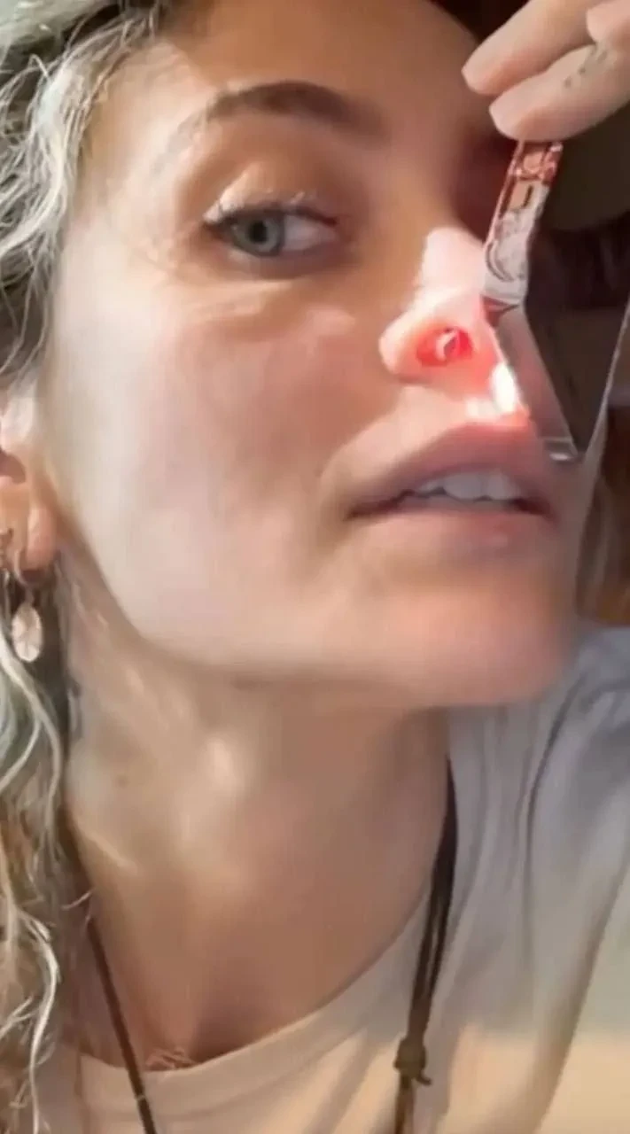 Дочь Майкла Джексона рассказала, что из-за наркотиков у неё образовалась дыра в носу